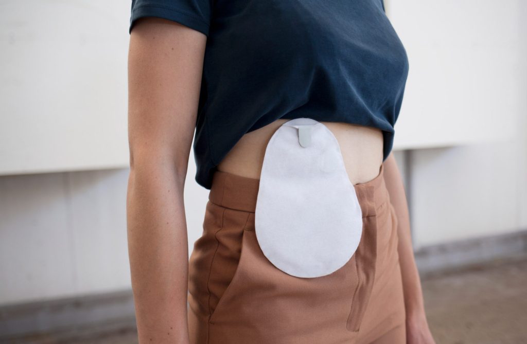 Stoma Friendly Clothing & Stoma Bag Covers for Everyday Comfort
