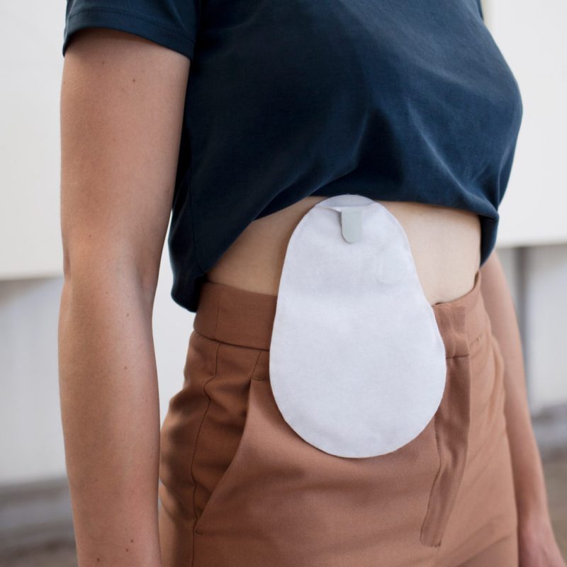 Stoma Friendly Clothing & Stoma Bag Covers for Everyday Comfort